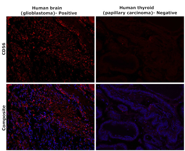 CD56 Antibody in Immunohistochemistry (Paraffin) (IHC (P))