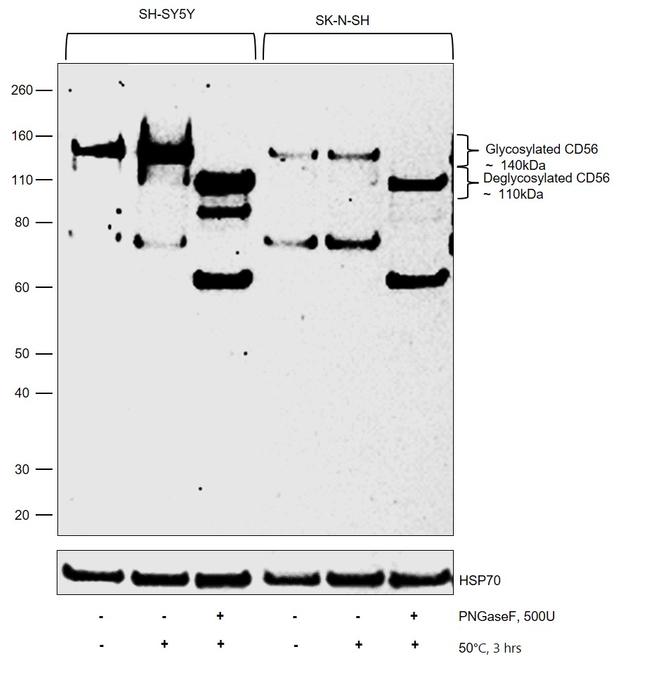 CD56 Antibody in Western Blot (WB)