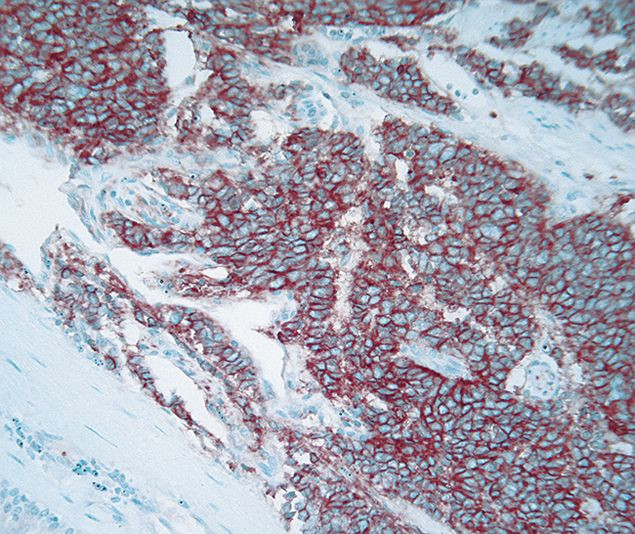 CD56 Antibody in Immunohistochemistry (IHC)