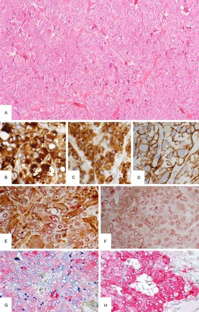 CD56 Antibody in Immunohistochemistry (Paraffin) (IHC (P))