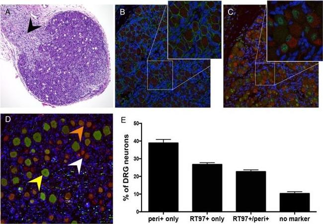 CD56 Antibody in Immunohistochemistry (IHC)