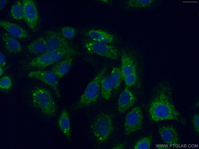 PITRM1 Antibody in Immunocytochemistry (ICC/IF)