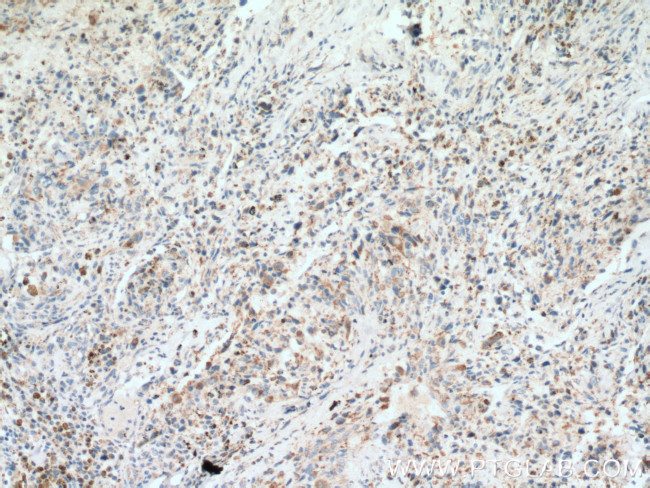 PITRM1 Antibody in Immunohistochemistry (Paraffin) (IHC (P))