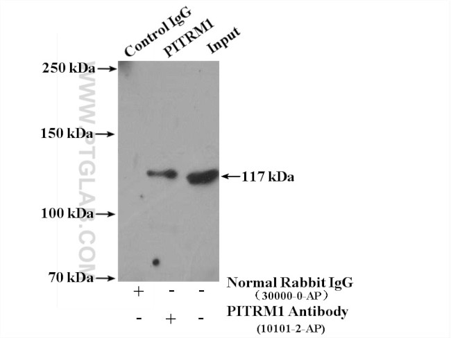 PITRM1 Antibody in Immunoprecipitation (IP)