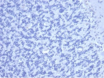 Carcinoembryonic Antigen (CEA)/CD66 Antibody in Immunohistochemistry (Paraffin) (IHC (P))