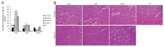 CD4 Antibody