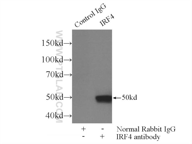 MUM1/IRF4 Antibody in Immunoprecipitation (IP)