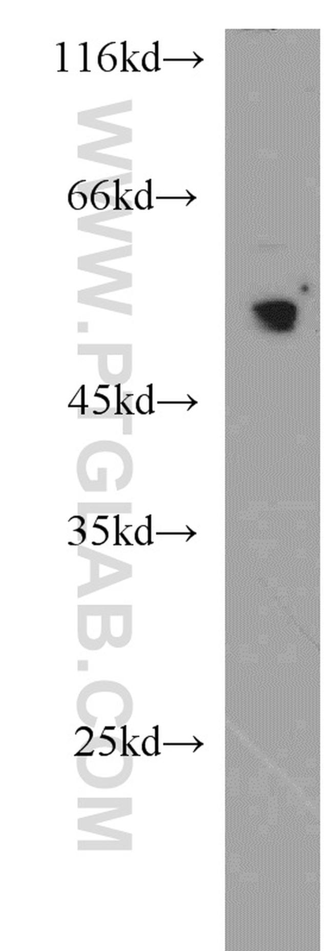 MUM1/IRF4 Antibody in Western Blot (WB)