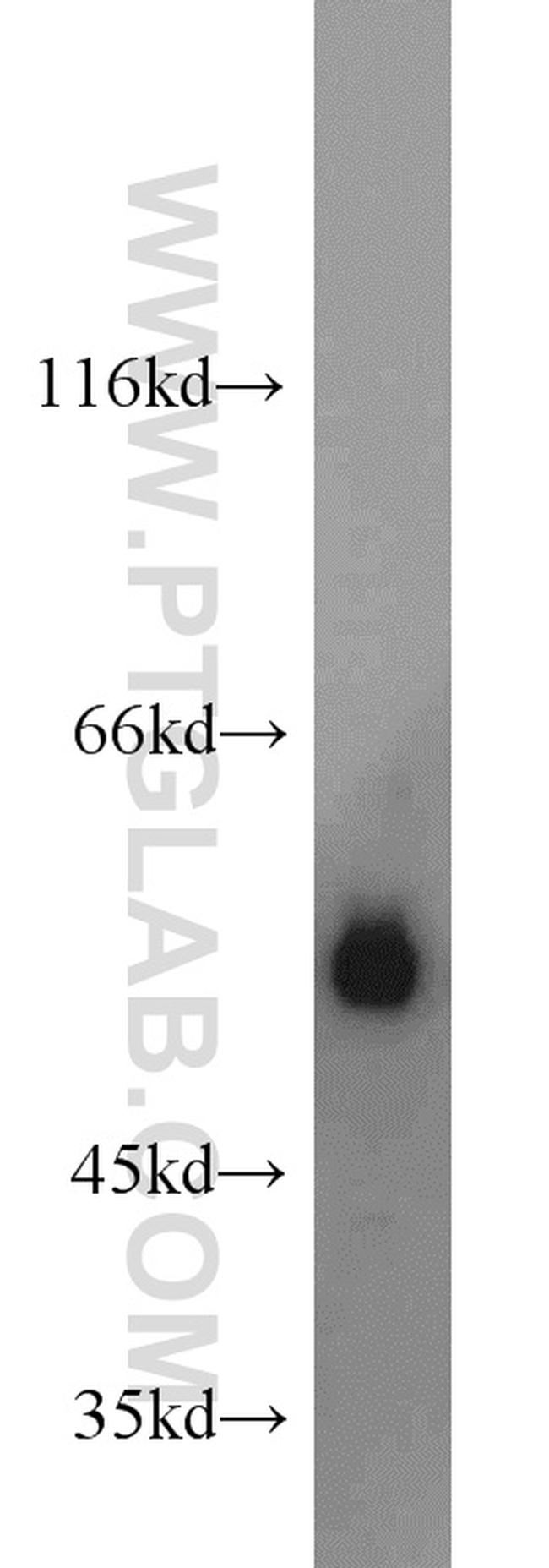 MUM1/IRF4 Antibody in Western Blot (WB)