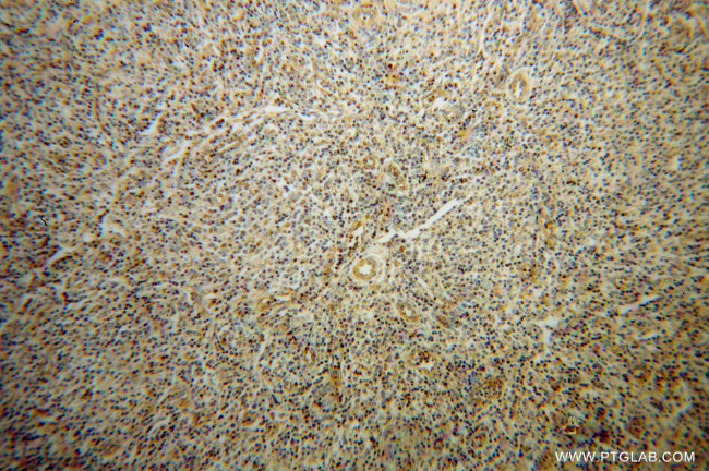 Granzyme A Antibody in Immunohistochemistry (Paraffin) (IHC (P))