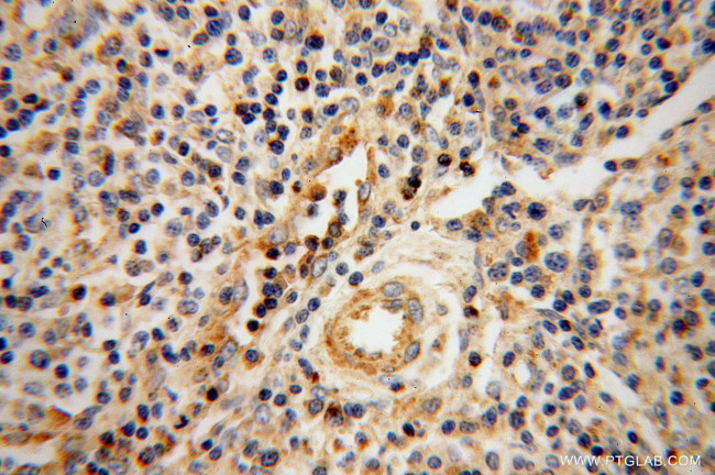 Granzyme A Antibody in Immunohistochemistry (Paraffin) (IHC (P))