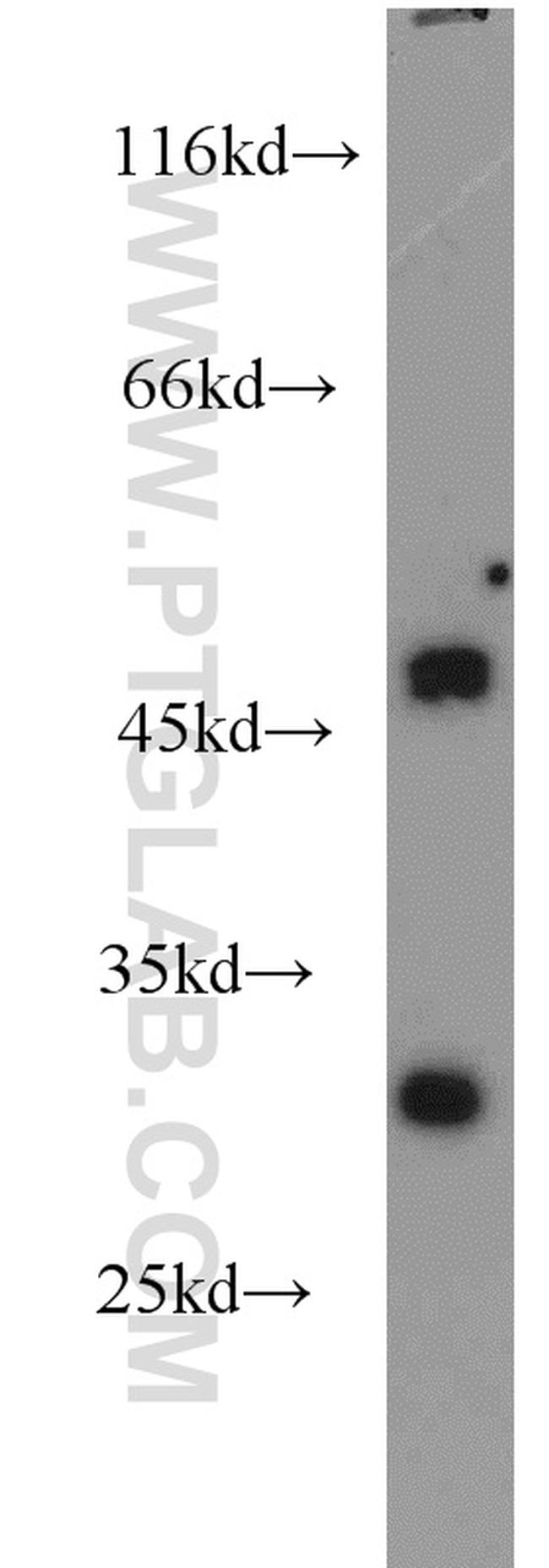 Granzyme A Antibody in Western Blot (WB)