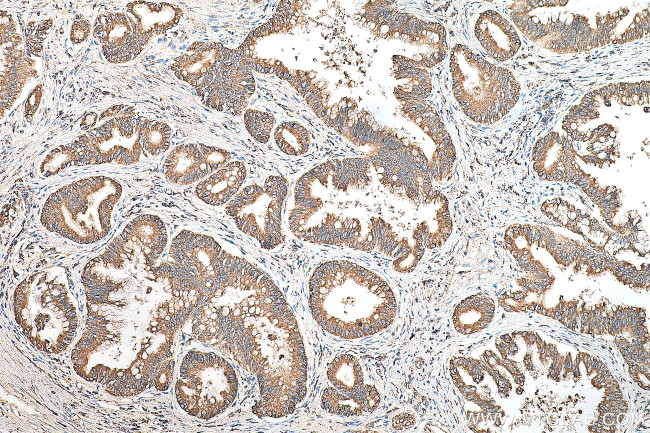 GRP78/BIP Antibody in Immunohistochemistry (Paraffin) (IHC (P))