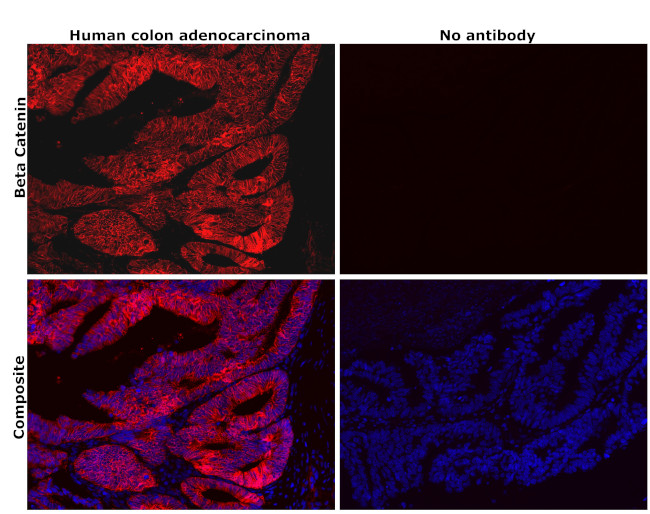 beta Catenin Antibody in Immunohistochemistry (Paraffin) (IHC (P))