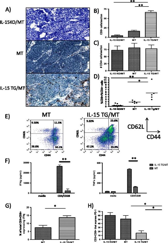 CD28 Antibody in Immunohistochemistry (IHC)