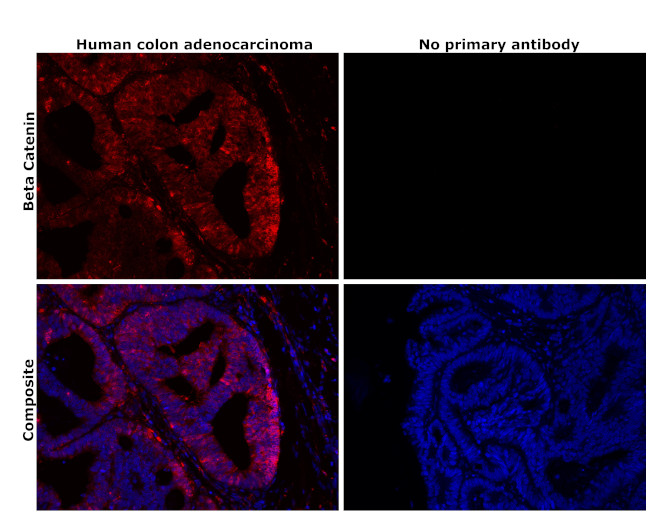 beta Catenin Antibody in Immunohistochemistry (Paraffin) (IHC (P))