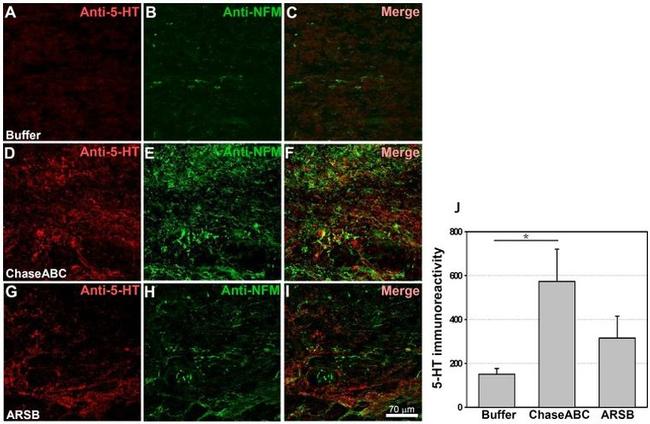 NEFM Antibody in Immunohistochemistry (IHC)