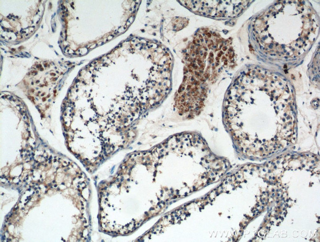 TNF beta Antibody in Immunohistochemistry (Paraffin) (IHC (P))