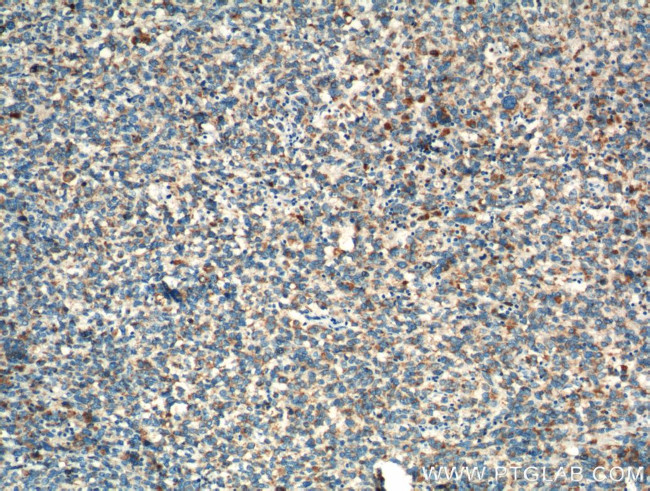 TNF beta Antibody in Immunohistochemistry (Paraffin) (IHC (P))