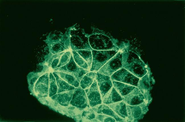 E-cadherin Antibody in Immunocytochemistry (ICC/IF)