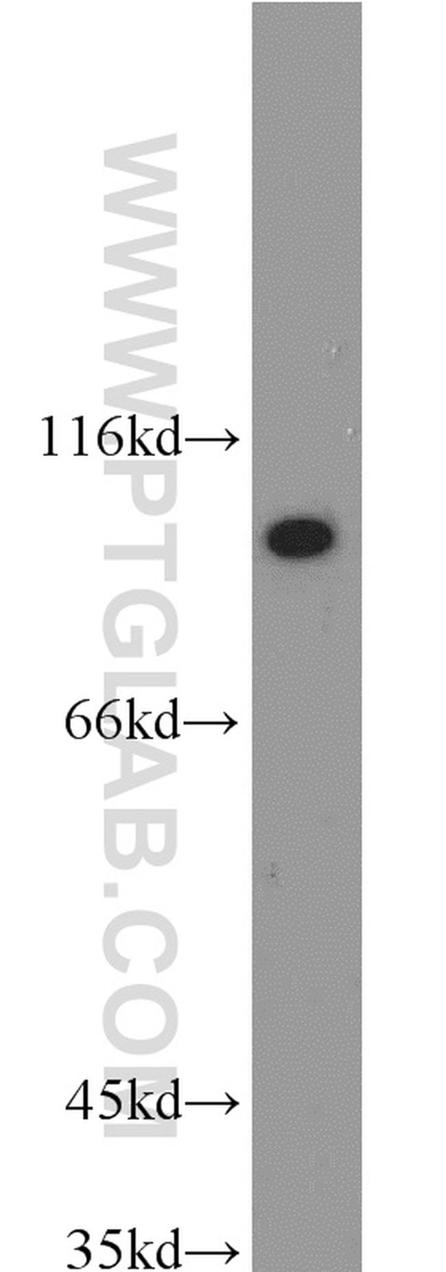 HSP90 Antibody in Western Blot (WB)