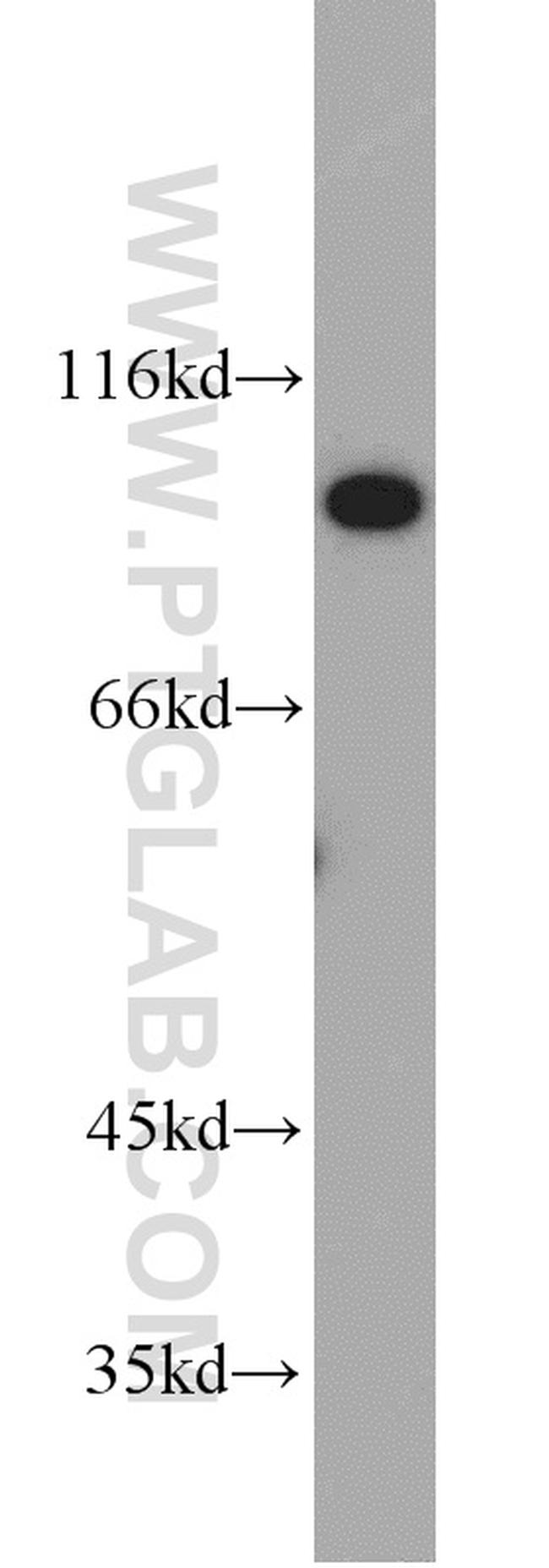 HSP90 Antibody in Western Blot (WB)