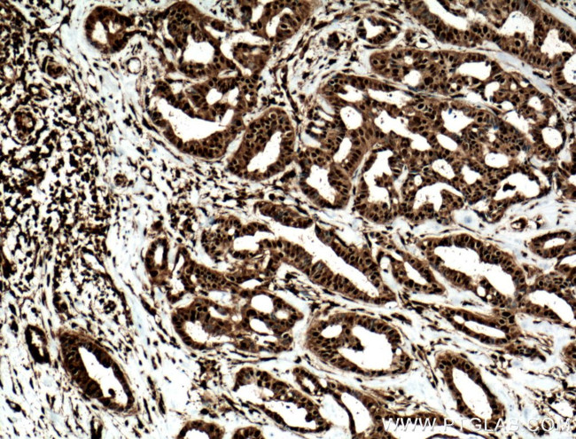 STAT5A Antibody in Immunohistochemistry (Paraffin) (IHC (P))