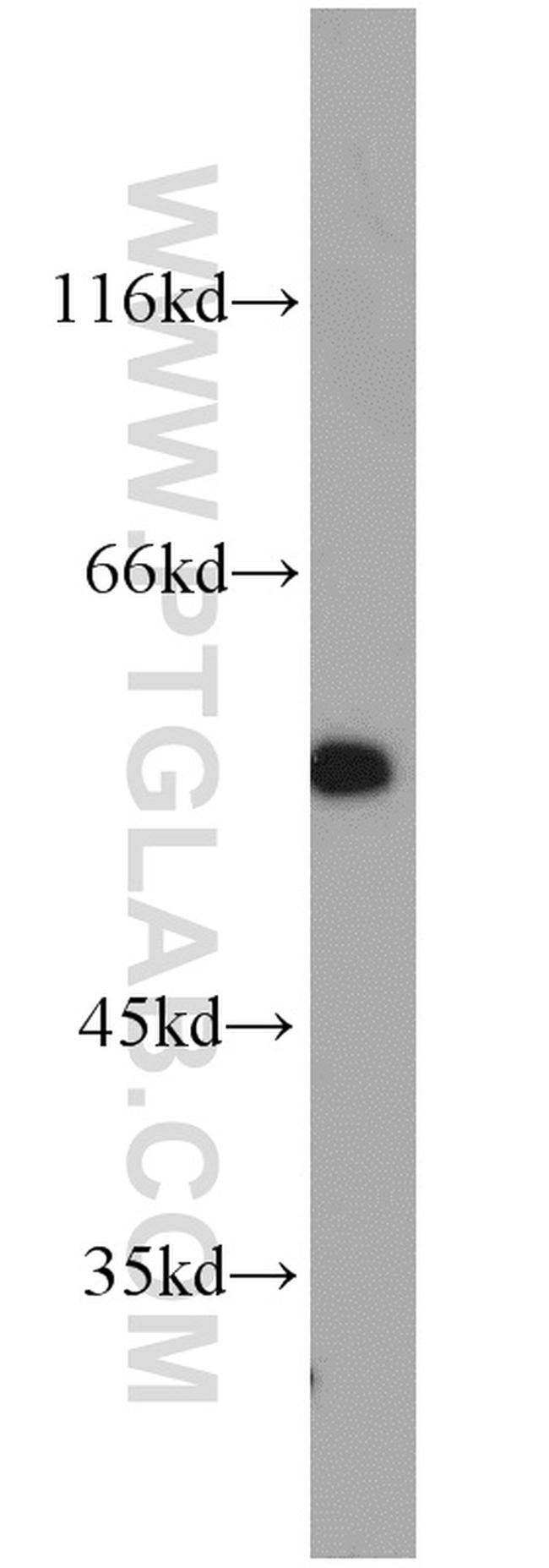 STAT5A Antibody in Western Blot (WB)