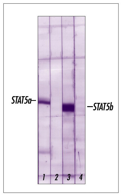 STAT5 beta Antibody in Western Blot (WB)