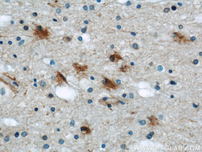 PRDX6 Antibody in Immunohistochemistry (Paraffin) (IHC (P))