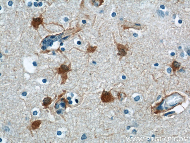 PRDX6 Antibody in Immunohistochemistry (Paraffin) (IHC (P))