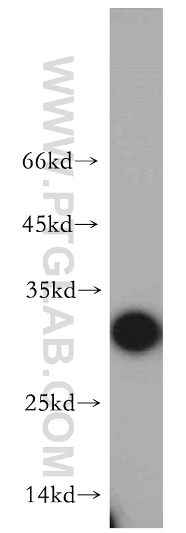 PRDX6 Antibody in Western Blot (WB)