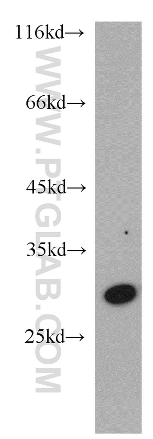 PRDX6 Antibody in Western Blot (WB)