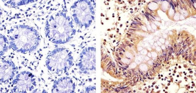 STAT3 Antibody in Immunohistochemistry (Paraffin) (IHC (P))