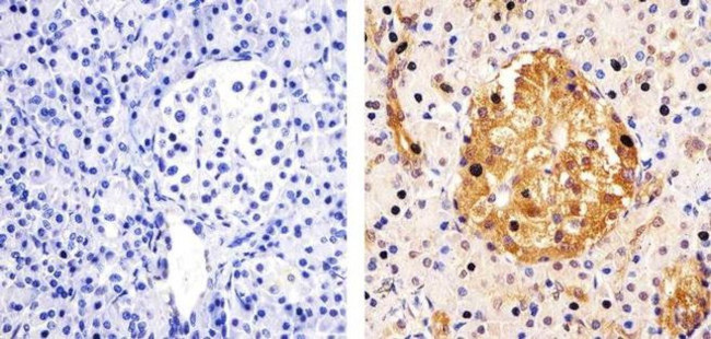 STAT3 Antibody in Immunohistochemistry (Paraffin) (IHC (P))