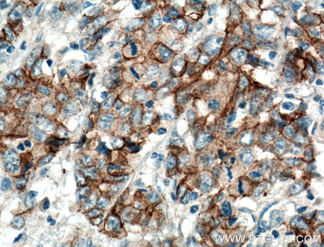 P-cadherin Antibody in Immunohistochemistry (Paraffin) (IHC (P))