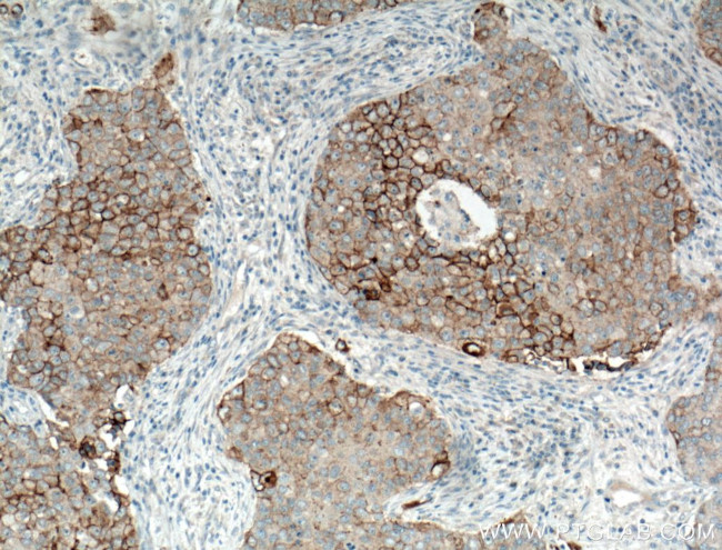 P-cadherin Antibody in Immunohistochemistry (Paraffin) (IHC (P))