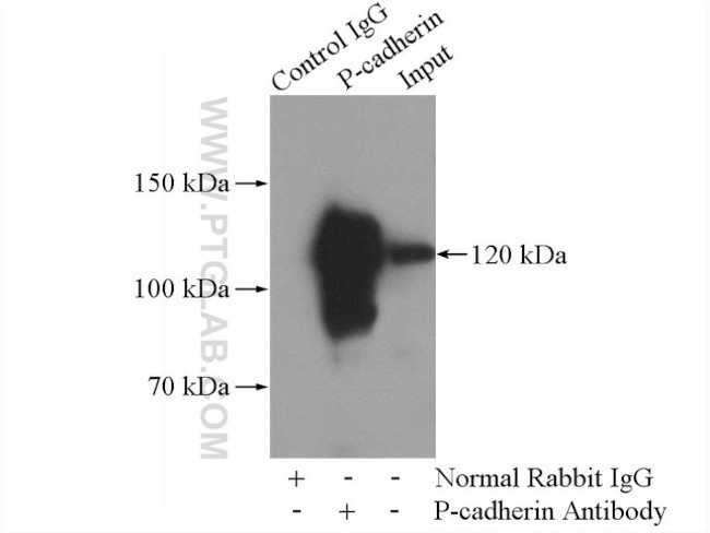 P-cadherin Antibody in Immunoprecipitation (IP)