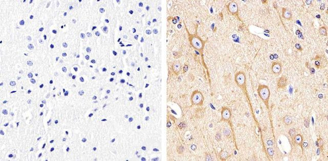 alpha Tubulin Antibody in Immunohistochemistry (Paraffin) (IHC (P))