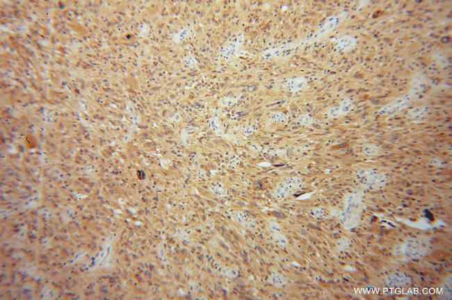 OLIG2 Antibody in Immunohistochemistry (Paraffin) (IHC (P))