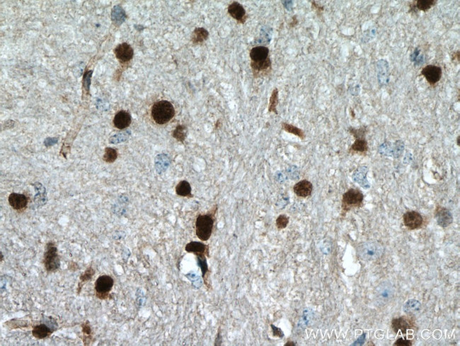 OLIG2 Antibody in Immunohistochemistry (Paraffin) (IHC (P))