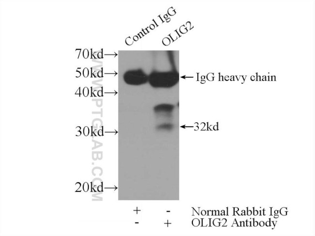 OLIG2 Antibody in Immunoprecipitation (IP)