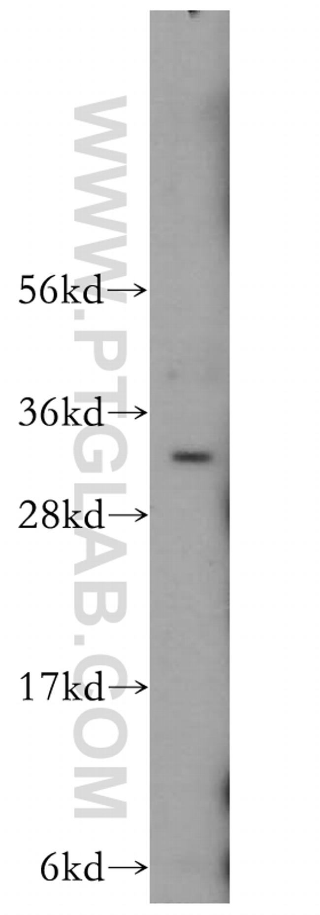 OLIG2 Antibody in Western Blot (WB)