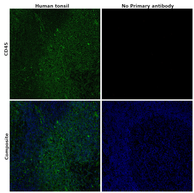 CD45 Antibody in Immunohistochemistry (Paraffin) (IHC (P))