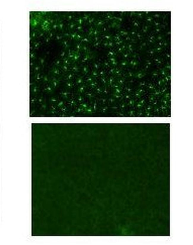 Rat IgG2a kappa Isotype Control in Immunohistochemistry (IHC)