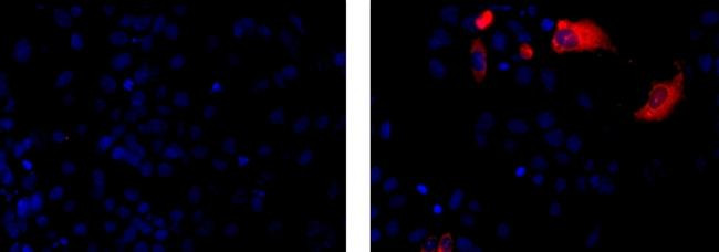 Mouse IgG1 kappa Isotype Control in Immunocytochemistry (ICC/IF)