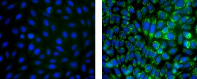 Mouse IgG1 kappa Isotype Control in Immunocytochemistry (ICC/IF)