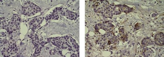 Mouse IgG1 kappa Isotype Control in Immunohistochemistry (Paraffin) (IHC (P))