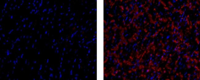 Mouse IgG1 kappa Isotype Control in Immunohistochemistry (Paraffin) (IHC (P))