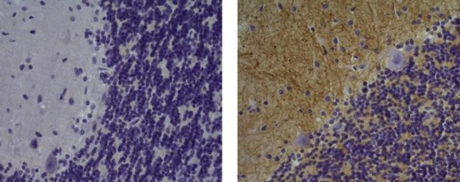 Mouse IgG1 kappa Isotype Control in Immunohistochemistry (Paraffin) (IHC (P))